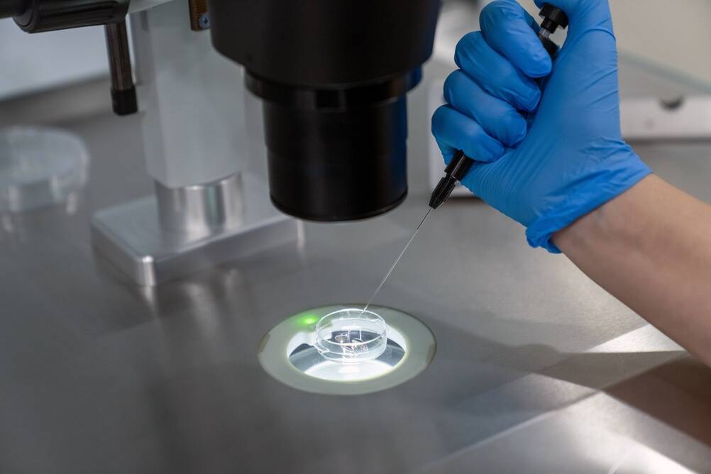 Fecundación asistida